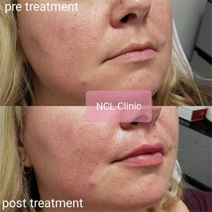 Nurse Care Link